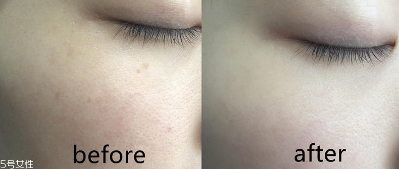 維納斯蒂爾淡斑精華怎么用 維納斯蒂爾淡斑精華用法 維納斯蒂爾淡斑精華怎么用 維納斯蒂爾淡斑精華用法