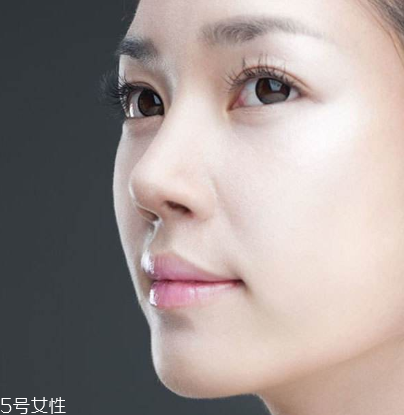 墊鼻尖后多久能做運動 墊鼻尖后做運動要注意什么 墊鼻尖后多久能做運動 墊鼻尖后做運動要注意什么