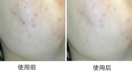 雪花秀潤(rùn)燥精華夏天用油嗎 雪花秀潤(rùn)燥精華適合夏天嗎 雪花秀潤(rùn)燥精華夏天用油嗎 雪花秀潤(rùn)燥精華適合夏天嗎