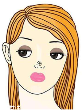 黑頭不管它會(huì)變大嗎？黑頭不管它會(huì)怎樣？