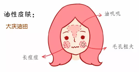 油性皮膚用什么粉餅好 拯救大慶油田 油性皮膚用什么粉餅好 拯救大慶油田