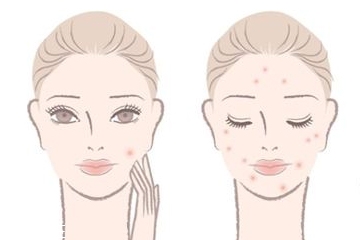 精華液什么成分能祛痘 挑對了令肌膚光滑如初 精華液什么成分能祛痘 挑對了令肌膚光滑如初