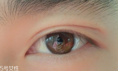 雙眼皮貼是妝前還是后 雙眼皮貼是妝前還是后