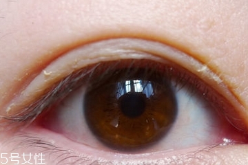 雙眼皮貼可以用什么代替 雙眼皮貼可以用什么代替