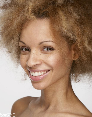 皮秒激光祛斑的弊端 主要是這4點(diǎn) 皮秒激光祛斑的弊端 主要是這4點(diǎn)