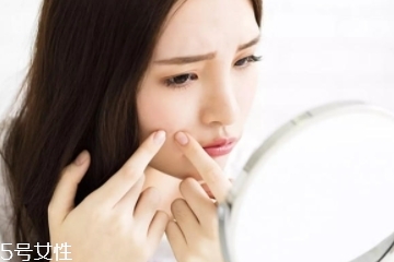 痘痘肌怎么改善 記住這5點(diǎn) 痘痘肌怎么改善 記住這5點(diǎn)