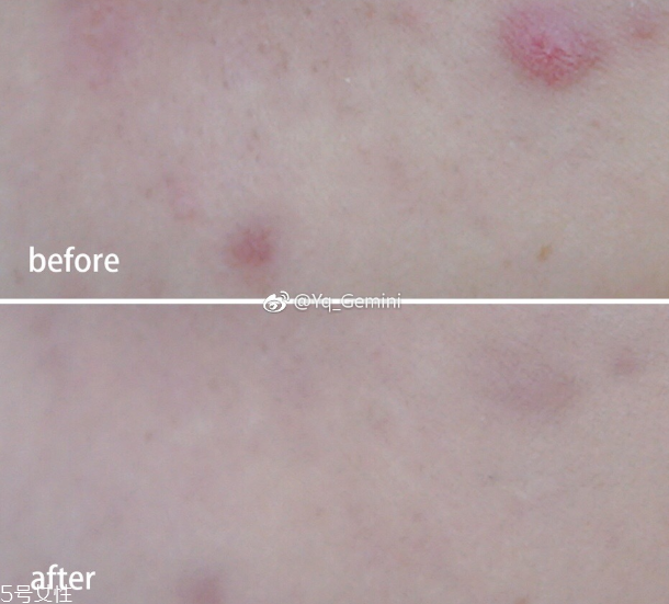 悅詩風(fēng)吟小白管怎么用 悅詩風(fēng)吟小白管使用方法 悅詩風(fēng)吟小白管怎么用 悅詩風(fēng)吟小白管使用方法