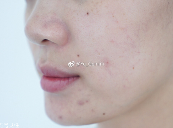 悅詩風(fēng)吟小白管怎么用 悅詩風(fēng)吟小白管使用方法 悅詩風(fēng)吟小白管怎么用 悅詩風(fēng)吟小白管使用方法