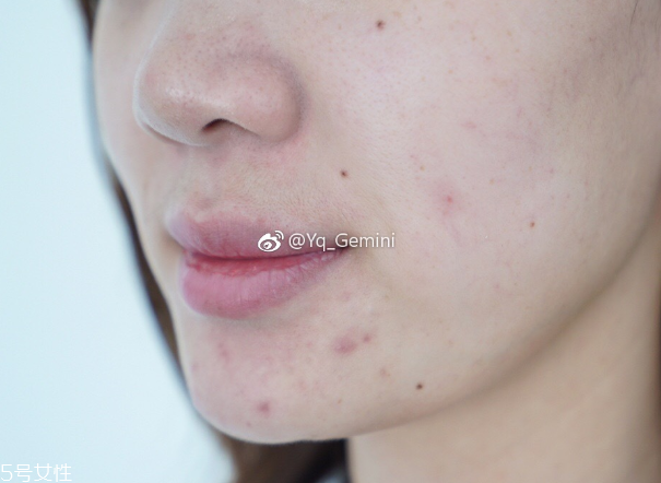 悅詩風(fēng)吟小白管怎么用 悅詩風(fēng)吟小白管使用方法 悅詩風(fēng)吟小白管怎么用 悅詩風(fēng)吟小白管使用方法