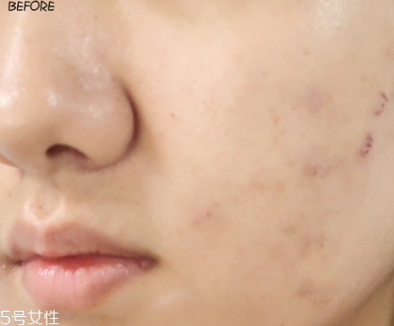 悅詩風(fēng)吟小白管怎么用 悅詩風(fēng)吟小白管使用方法 悅詩風(fēng)吟小白管怎么用 悅詩風(fēng)吟小白管使用方法