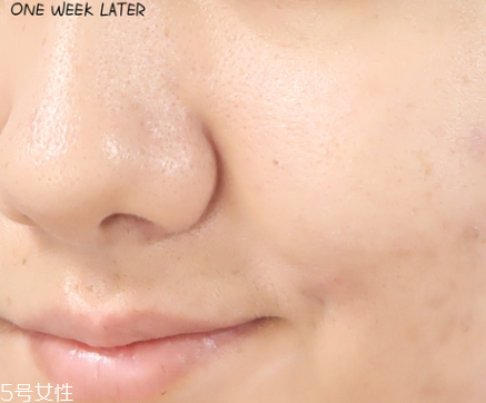 悅詩風(fēng)吟小白管怎么用 悅詩風(fēng)吟小白管使用方法 悅詩風(fēng)吟小白管怎么用 悅詩風(fēng)吟小白管使用方法