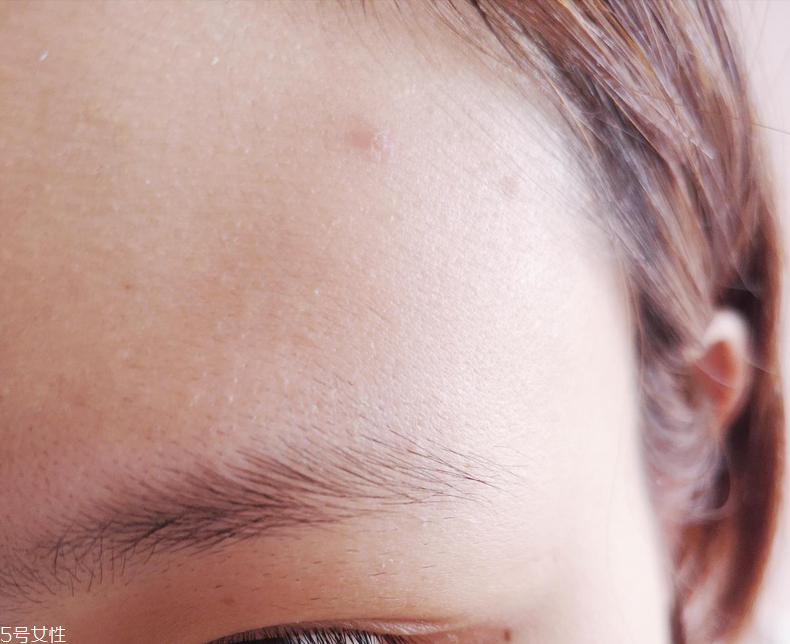 悅詩風(fēng)吟小白管好用嗎 去痘印能力驚人 悅詩風(fēng)吟小白管好用嗎 去痘印能力驚人