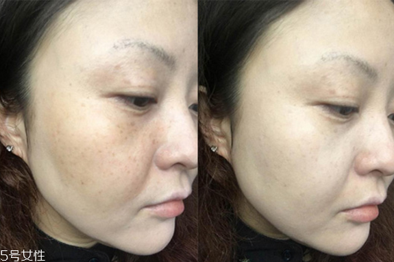 歐萊雅氣墊好用嗎 歐萊雅氣墊cc霜使用測評 歐萊雅氣墊好用嗎 歐萊雅氣墊cc霜使用測評