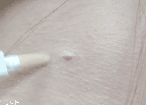 臉上瑕疵多用什么遮蓋 遮瑕要選好 臉上瑕疵多用什么遮蓋 遮瑕要選好