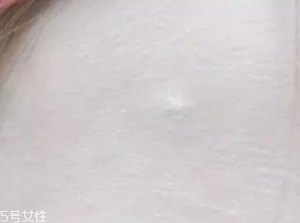 臉上瑕疵多用什么遮蓋 遮瑕要選好 臉上瑕疵多用什么遮蓋 遮瑕要選好