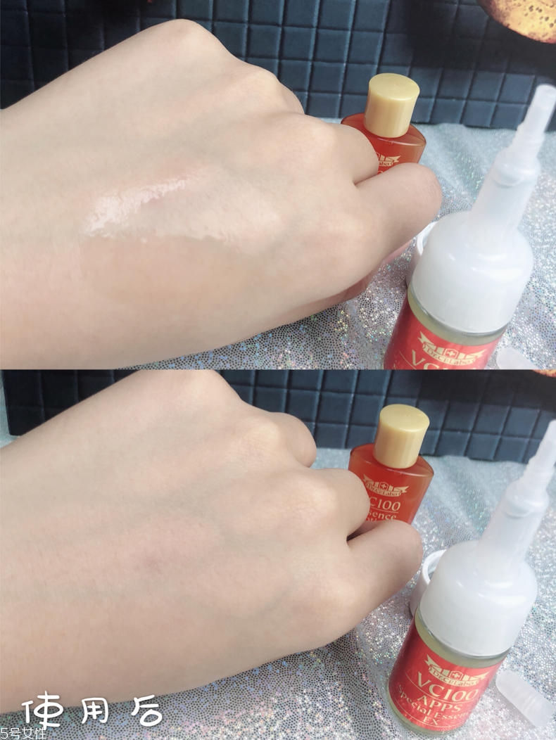 城野醫(yī)生vc100凍干安瓶精華有效嗎 1個(gè)月追蹤報(bào)告 城野醫(yī)生vc100凍干安瓶精華有效嗎 1個(gè)月追蹤報(bào)告