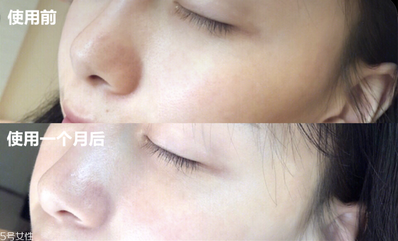 城野醫(yī)生vc100凍干安瓶精華有效嗎 1個(gè)月追蹤報(bào)告 城野醫(yī)生vc100凍干安瓶精華有效嗎 1個(gè)月追蹤報(bào)告