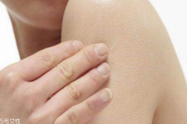 身體需要去角質(zhì)嗎 四個(gè)征兆告訴你 身體需要去角質(zhì)嗎 四個(gè)征兆告訴你
