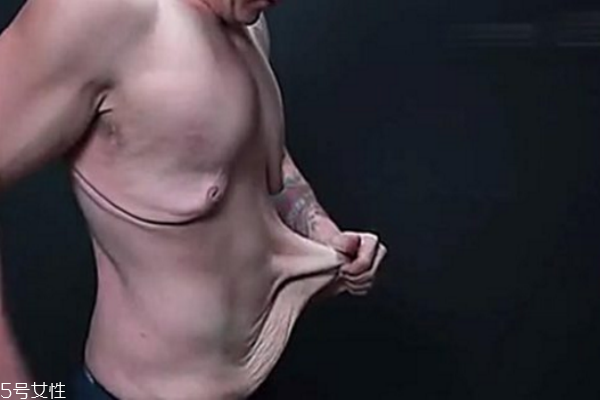 皮膚松弛，你應該為肌膚補充營養(yǎng)