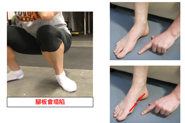 亞洲蹲怎么練圖解 小心4個錯誤蹲姿傷害 亞洲蹲怎么練圖解 小心4個錯誤蹲姿傷害