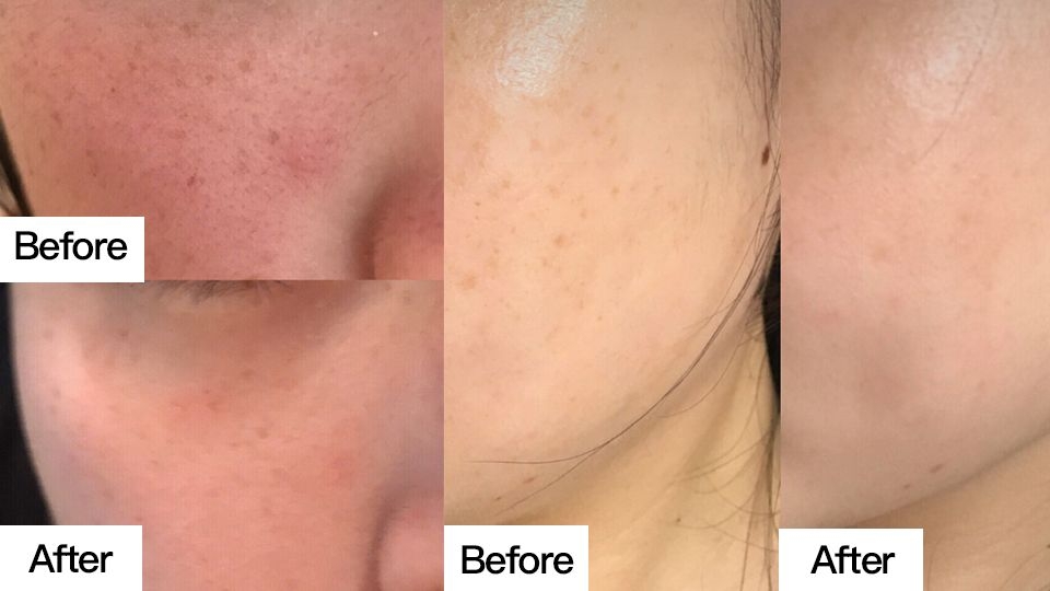 祛斑膏哪個牌子好 爆款祛斑膏推薦 祛斑膏哪個牌子好 爆款祛斑膏推薦