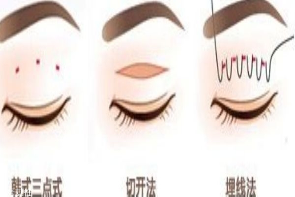 韓式三點和埋線的區(qū)別 你適合做什么樣的 韓式三點和埋線的區(qū)別 你適合做什么樣的