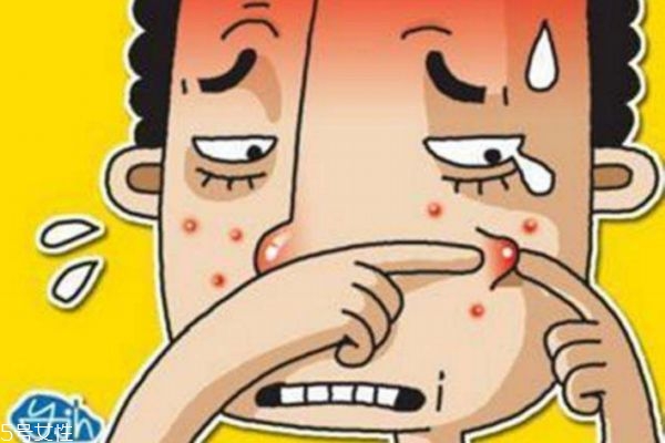 快速祛痘的方法有哪些 快速祛痘小妙招 快速祛痘的方法有哪些 快速祛痘小妙招