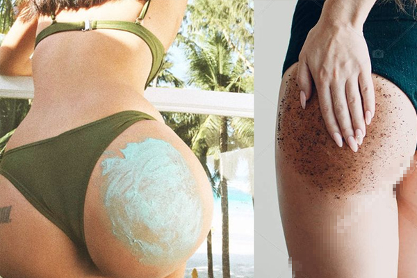 屁股長痘痘怎么辦 簡單4招跟著做 屁股長痘痘怎么辦 簡單4招跟著做