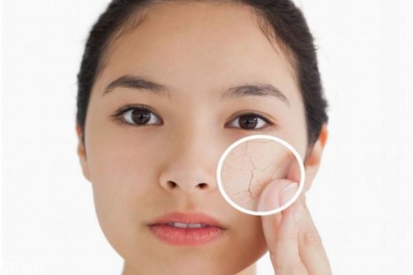 自制皮膚補(bǔ)水小妙招 臉部最簡(jiǎn)單的補(bǔ)水方法 自制皮膚補(bǔ)水小妙招 臉部最簡(jiǎn)單的補(bǔ)水方法