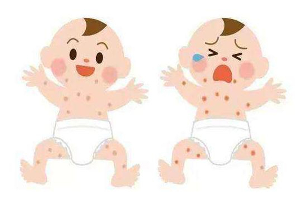 寶寶臉上長奶癬是怎么回事怎么辦 寶寶臉上長奶癬是怎么回事怎么辦