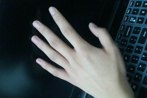 冬季如何治療皮膚干裂?五個(gè)方法有效解決 冬季如何治療皮膚干裂?五個(gè)方法有效解決