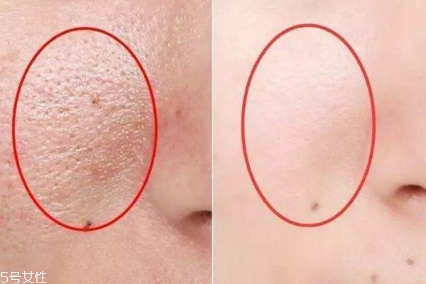 皮膚細(xì)膩零毛孔，教你三招搞定