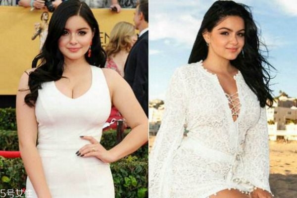 縮胸手術(shù)大概多少錢 縮胸手術(shù)大概多少錢