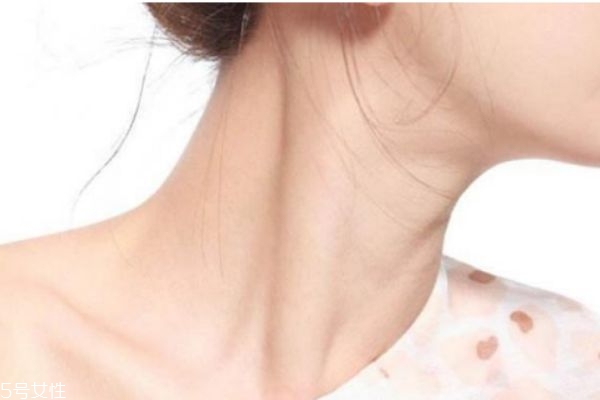 頸紋可以預防嗎 預防頸紋很重要 頸紋可以預防嗎 預防頸紋很重要