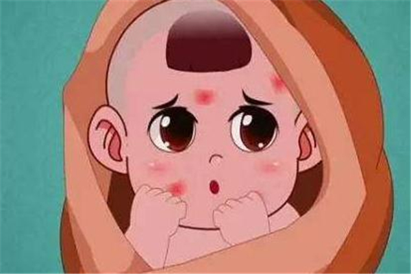 什么是玫瑰糠疹 如何鑒定玫瑰糠疹 什么是玫瑰糠疹 如何鑒定玫瑰糠疹