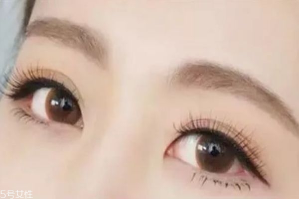 美瞳線適合哪些人 什么人不適合做美瞳線 美瞳線適合哪些人 什么人不適合做美瞳線