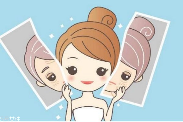 激光祛斑真的有效嗎 激光祛斑好嗎 激光祛斑真的有效嗎 激光祛斑好嗎