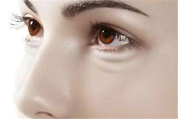 黑眼圈是身體哪里不好嗎 黑眼圈的形成 黑眼圈是身體哪里不好嗎 黑眼圈的形成