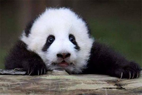 黑眼圈是身體哪里不好嗎 黑眼圈的形成 黑眼圈是身體哪里不好嗎 黑眼圈的形成