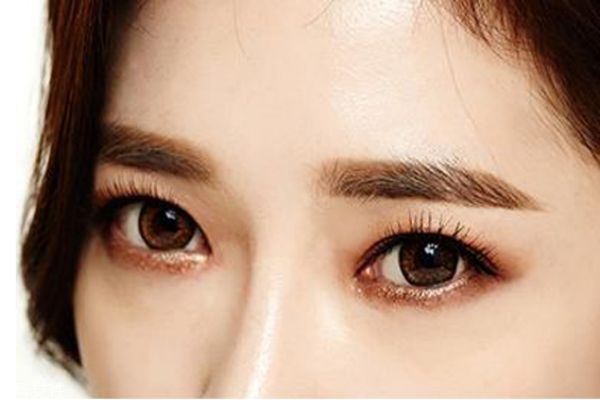 激光去痘印后會反黑嗎 激光去痘印術(shù)后反黑原因 激光去痘印后會反黑嗎 激光去痘印術(shù)后反黑原因