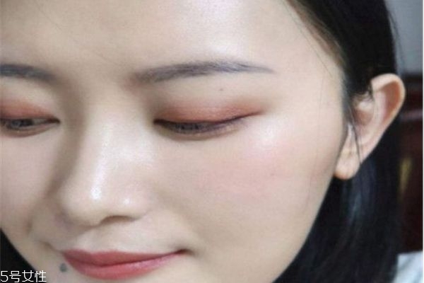 水光針能收縮毛孔嗎 水光針打完多久起效果 水光針能收縮毛孔嗎 水光針打完多久起效果