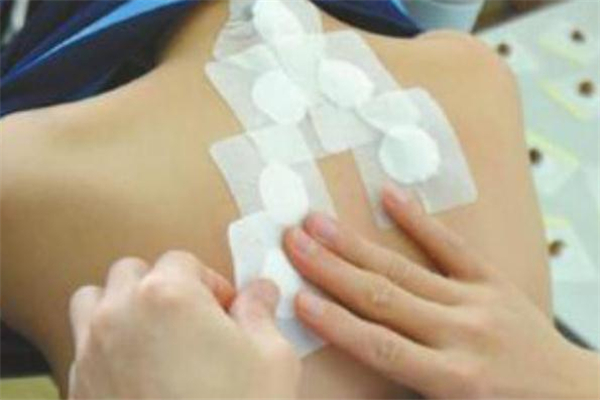 三伏貼長毛了還能貼嗎 三伏貼長毛什么原因 三伏貼長毛了還能貼嗎 三伏貼長毛什么原因