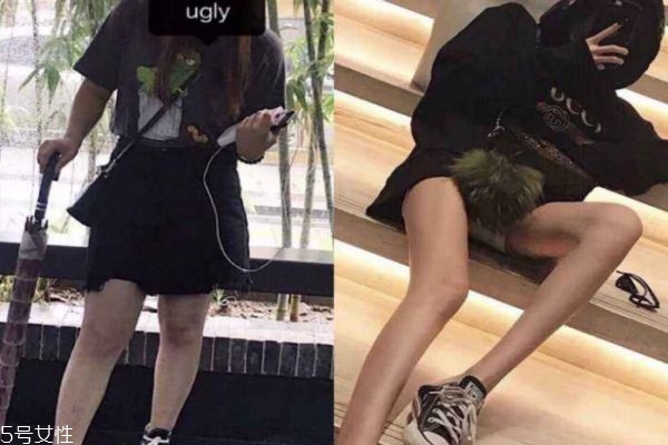 瘦腿針可以反復(fù)打嗎 打瘦腿針小腿可以瘦多少厘米 瘦腿針可以反復(fù)打嗎 打瘦腿針小腿可以瘦多少厘米