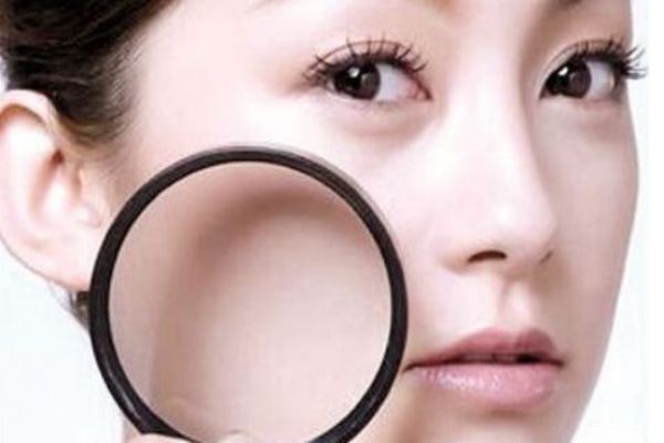 臉上的毛孔為什么會變大 毛孔為什么會變粗 臉上的毛孔為什么會變大 毛孔為什么會變粗