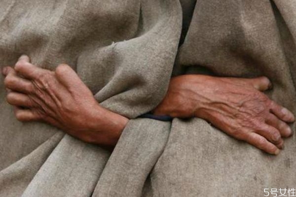 什么是麻風(fēng)病呢 麻風(fēng)病有實(shí)名癥狀呢 什么是麻風(fēng)病呢 麻風(fēng)病有實(shí)名癥狀呢