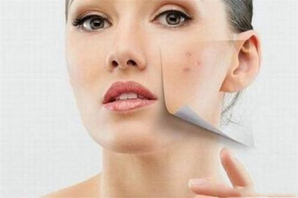 痘痘的日常預(yù)防 各種痘痘形成的原因 痘痘的日常預(yù)防 各種痘痘形成的原因