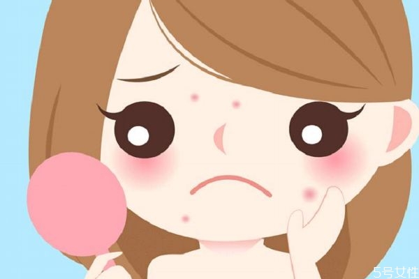 紅痘印怎么消除 去除紅痘印的辦法有什么 紅痘印怎么消除 去除紅痘印的辦法有什么