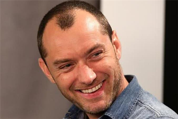 禿頂適合什么發(fā)型 中年禿頂留什么發(fā)型好 禿頂適合什么發(fā)型 中年禿頂留什么發(fā)型好