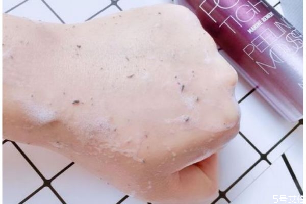 去角質(zhì)要避開痘痘嗎 去角質(zhì)需要避開痘痘嗎 去角質(zhì)要避開痘痘嗎 去角質(zhì)需要避開痘痘嗎